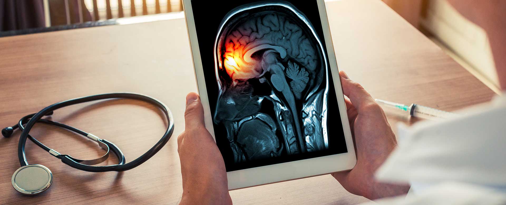 Migräne: Arzt hölt Tablet in der Hand mit Bild eines Gehirns