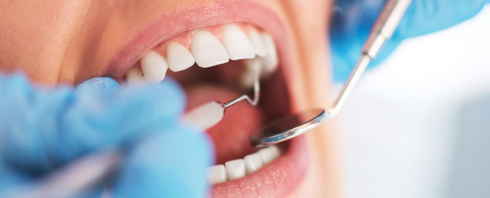 Zahn abgebrochen - Behandlung