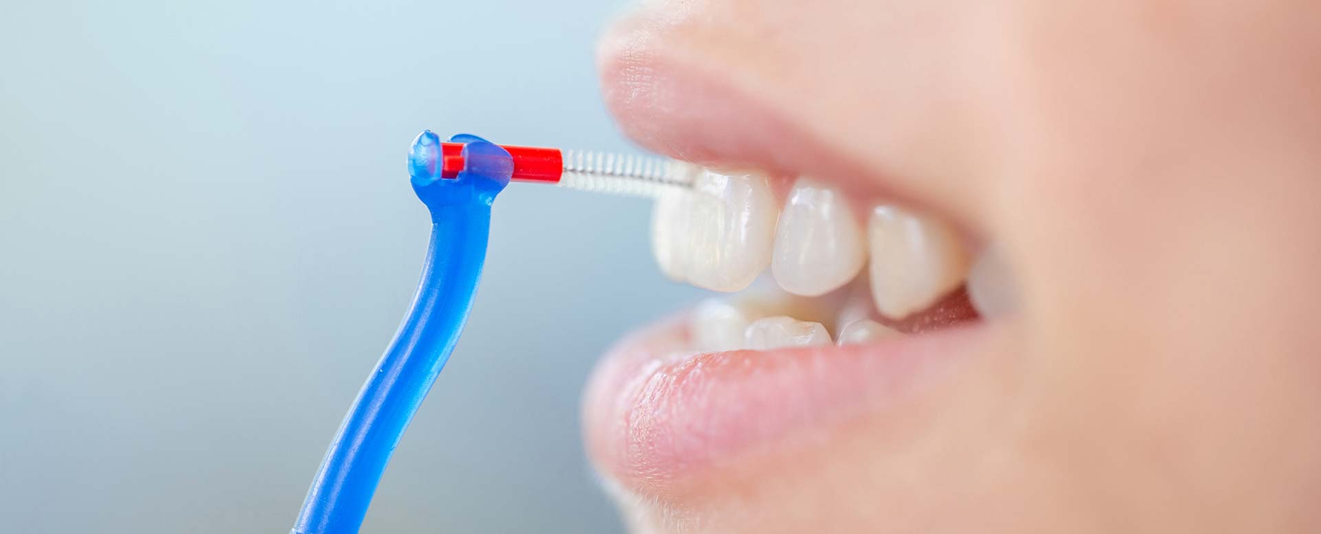Zahnzwischenräume reinigen: So beugen Sie Karies und Paradontitis vor
